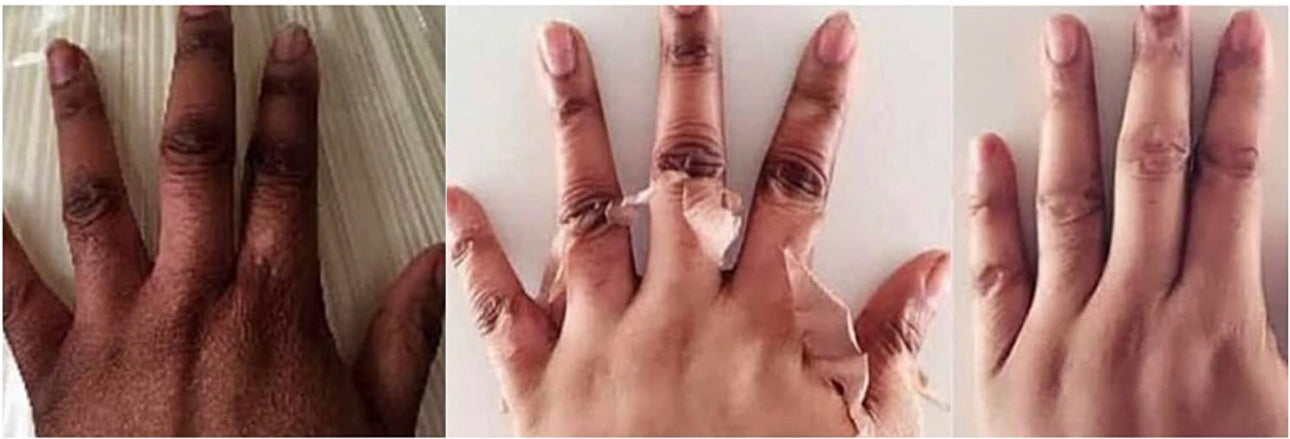 Extra Strong Peeling Oil